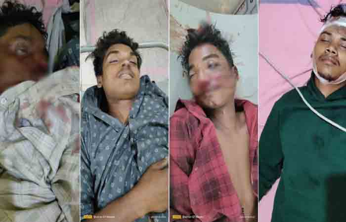 CG Road Accident: तेज रफ्तार ट्रक ने दो बाइक सवार युवकों को मरी टक्कर, 3 की मौत,1 घायल