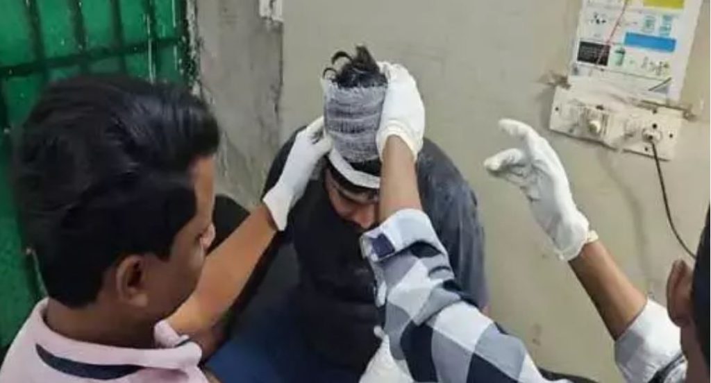 फाइनेंस डिपार्टमेंट की गुंडागर्दी, किस्त न पटाने पर फोड़ा युवक का सिर, मामला दर्ज