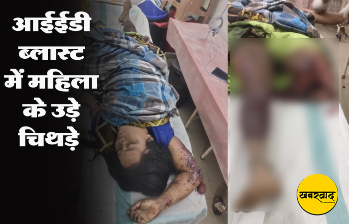 आईईडी की चपेट में आई महिला, पैर के उड़े चिथड़े… तस्वीर देख दिल दहल जाएगा