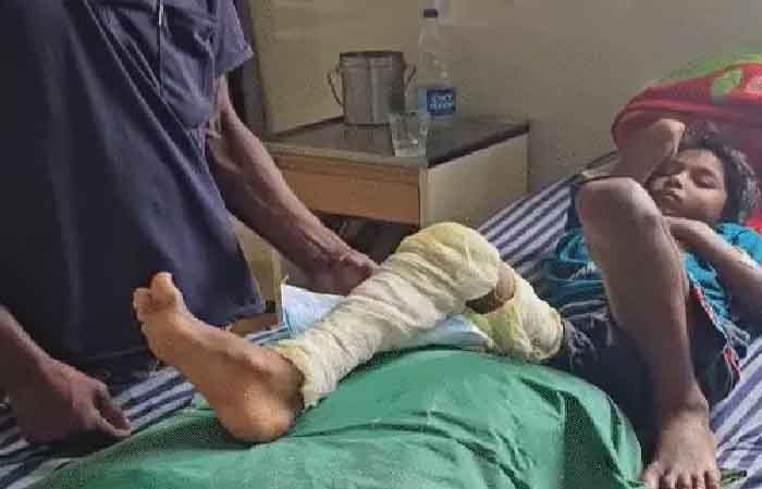 हेडमास्टर की पिटाई से कक्षा 2 की छात्रा गंभीर रूप से घायल, पैर में फ्रैक्चर, BEO बोले- नहीं मिली शिकायत हेडमास्टर की पिटाई से कक्षा 2 की छात्रा गंभीर रूप से घायल, पैर में फ्रैक्चर, BEO बोले- नहीं मिली शिकायत